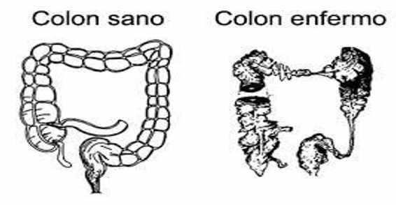 colon